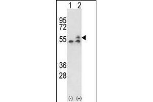 Western blot analysis of ATP5B (arrow) using rabbit polyclonal ATP5B Antibody (Center) (ABIN650786 and ABIN2839558). (ATP5B 抗体  (AA 135-163))