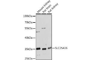 Western Blotting (WB) image for anti-Solute Carrier Family 25 (Mitochondrial Carrier, Graves Disease Autoantigen), Member 16 (SLC25A16) (AA 200-300) antibody (ABIN7270432)