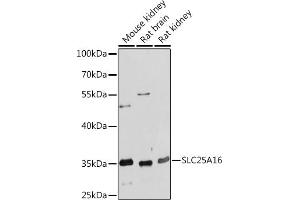 Western blot analysis of extracts of various cell lines, using SLC25 Rabbit pAb (ABIN7270432) at 1:1000 dilution. (SLC25A16 抗体  (AA 200-300))