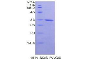 SDS-PAGE analysis of Mouse NEK2 Protein. (NEK2 蛋白)