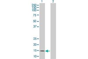 Western Blot analysis of CREBL2 expression in transfected 293T cell line by CREBL2 MaxPab polyclonal antibody. (CREBL2 抗体  (AA 1-120))