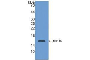 Western blot analysis of recombinant Human MT1. (MT1 抗体  (AA 1-61))