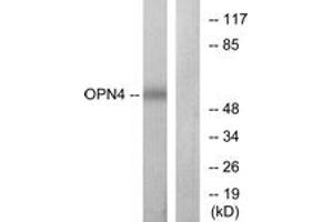 Western blot analysis of extracts from COLO cells, using OPN4 Antibody. (OPN4 抗体  (AA 429-478))
