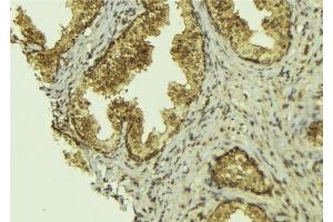 ABIN6276517 at 1/100 staining Mouse colon tissue by IHC-P. (BCL2L13 抗体  (Internal Region))