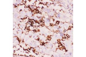 Immunohistochemistry (IHC) image for anti-Integrin beta 2 (ITGB2) (AA 404-769) antibody (ABIN3043260)