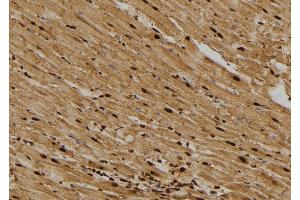 ABIN6276385 at 1/100 staining Rat heart tissue by IHC-P. (CDCA8 抗体)