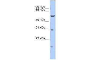 WB Suggested Anti-HOXC5 Antibody Titration: 0. (Homeobox C5 抗体  (Middle Region))