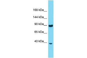 Western Blotting (WB) image for anti-Ring Finger Protein 216 (RNF216) (N-Term) antibody (ABIN2774202) (RNF216 抗体  (N-Term))