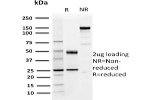 SDS-PAGE (SDS) image for anti-CD274 (PD-L1) (AA 39-191), (Extracellular Domain) antibody (ABIN6383847)