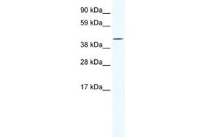 WB Suggested Anti-IRX6 Antibody Titration:  1. (IRX6 抗体  (C-Term))