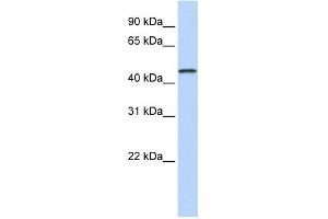 WB Suggested Anti-MAGEA10 Antibody Titration:  0. (MAGEA10 抗体  (Middle Region))