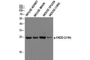Western Blot (WB) analysis of Mouse Kidney Mouse Brain Mouse Spleen Mouse Lung using p-FADD (S194) antibody. (FADD 抗体  (pSer194))