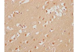 IHC image of ABIN7151483 diluted at 1:200 and staining in paraffin-embedded human brain tissue performed on a Leica BondTM system.