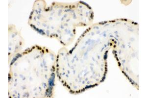 IHC analysis of DDB1 using anti-DDB1 antibody . (DDB1 抗体  (AA 1011-1140))