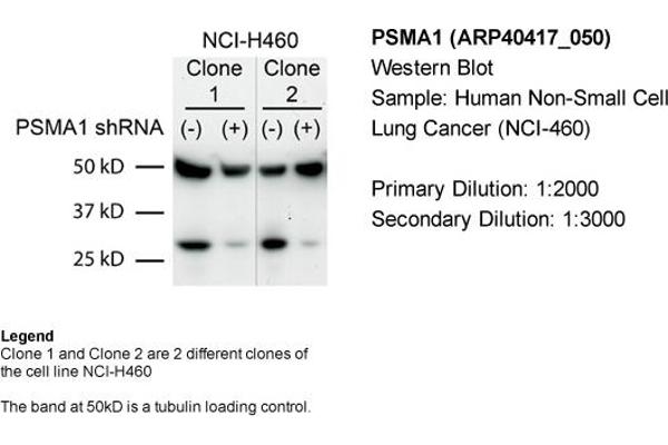 PSMA1 抗体  (C-Term)
