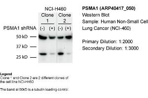 Sample Type: Human non-small cell lung cancer (NCI-460)Primary Dilution: 1:2000Secondary Dilution: 1:300050kDa band is a tubulin loading control band (PSMA1 抗体  (C-Term))