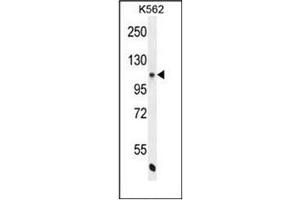 Western blot analysis of NOS3 Antibody  in K562 cell line lysates (35ug/lane). (ENOS 抗体  (AA 1163-1191))