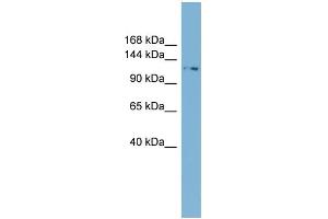 WB Suggested Anti-TTC17 Antibody Titration: 0. (TTC17 抗体  (N-Term))