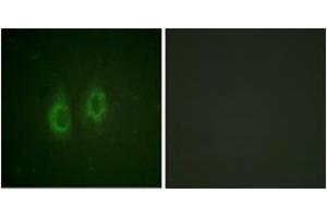 Immunofluorescence analysis of HeLa cells, using Connexin 43 (Ab-261) Antibody.