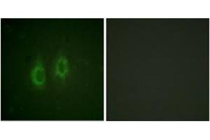 Immunofluorescence analysis of HeLa cells, using Connexin 43 (Ab-261) Antibody. (Connexin 43/GJA1 抗体  (AA 226-275))