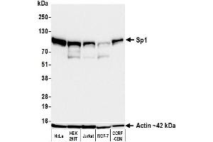 Western Blotting (WB) image for anti-Sp1 Transcription Factor (SP1) (AA 250-300) antibody (ABIN7795788) (Recombinant SP1 抗体  (AA 250-300))
