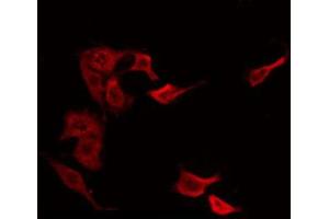ABIN6266557 staining NIH-3T3 by IF/ICC. (HCG beta 抗体)