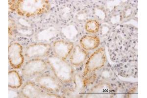 Image no. 1 for anti-ACC Synthase-Like Protein 1 (ACCS) (AA 1-101) antibody (ABIN466256) (PHACS 抗体  (AA 1-101))