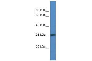WB Suggested Anti-TBRG1 Antibody Titration: 0. (TBRG1 抗体  (N-Term))