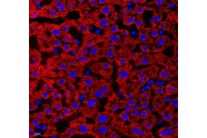 Immunofluorescence of paraffin embedded human liver using Aldh4a1 (ABIN7073000) at dilution of 1: 400 (400x lens) (ALDH4A1 抗体)