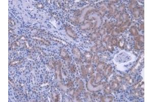 Detection of PEBP1 in Mouse Kidney Tissue using Polyclonal Antibody to Phosphatidylethanolamine Binding Protein 1 (PEBP1) (PEBP1 抗体  (AA 2-187))