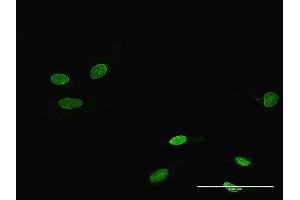 Immunofluorescence of purified MaxPab antibody to RORA on HeLa cell. (RORA 抗体  (AA 1-468))
