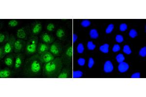 Immunofluorescence (Cultured Cells) (IF (cc)) image for anti-Signal Transducer and Activator of Transcription 3 (Acute-Phase Response Factor) (STAT3) (pSer727) antibody (ABIN5557530)