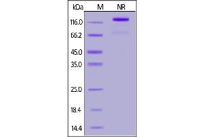 SDS-PAGE (SDS) image for CD40 Ligand (CD40LG) (AA 116-261) (Active) protein (Fc Tag) (ABIN7013418)