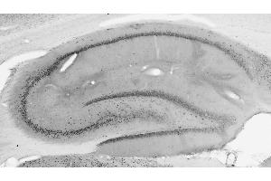 Immunoblot versus samples from adult rat brain (RBLSP) and WT and BAF53b KO mouse brains probed with N332B/15 (left) and N336B/83 (right) TC supes. (Actin-Like 6B 抗体  (AA 39-114))