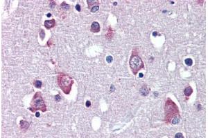Brain, cortex, Human: Formalin-Fixed, Paraffin-Embedded (FFPE) (BDNF 抗体  (AA 183-194))