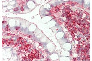 Immunohistochemistry (IHC) image for anti-ST3 beta-Galactoside alpha-2,3-Sialyltransferase 4 (ST3GAL4) (Middle Region) antibody (ABIN2782704)