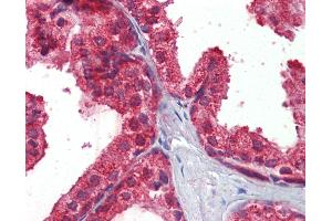 Anti-CLIP1 / CLIP170 antibody IHC of human prostate. (CLIP1 抗体  (AA 1404-1417))