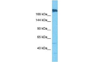 Host:  Rabbit  Target Name:  SNRNP200  Sample Tissue:  Human A549 Whole Cell  Antibody Dilution:  1ug/ml (SNRNP200 抗体  (N-Term))