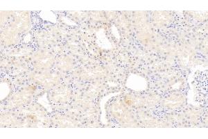 Detection of IL12B in Human Kidney Tissue using Monoclonal Antibody to Interleukin 12B (IL12B) (IL12B 抗体  (AA 30-320))