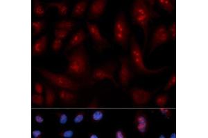 Immunofluorescence analysis of U2OS cells using PLCB1 Polyclonal Antibody (Phospholipase C beta 1 抗体)