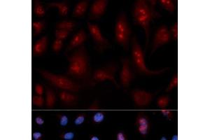Immunofluorescence analysis of U2OS cells using PLCB1 Polyclonal Antibody (Phospholipase C beta 1 抗体)