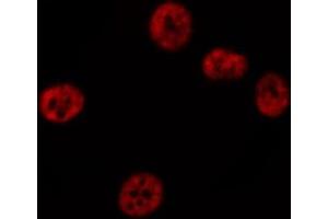 Immunofluorescence (fixed cells) (IF/ICC) image for anti-Signal Transducer and Activator of Transcription 3 (Acute-Phase Response Factor) (STAT3) (pSer727) antibody (ABIN6256411)