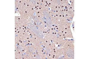 Immunohistochemistry of paraffin-embedded mouse brain using CTIP2/BCL11B Rabbit mAb (ABIN7265807) at dilution of 1:100 (40x lens). (BCL11B 抗体)