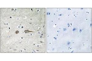 Immunohistochemistry analysis of paraffin-embedded human brain tissue, using MADD Antibody. (MADD 抗体  (AA 751-800))