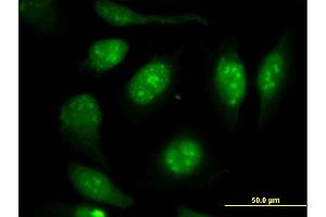 Immunofluorescence (IF) image for anti-Vimentin (VIM) (AA 41-140) antibody (ABIN563373)