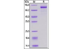 SDS-PAGE (SDS) image for Receptor tyrosine-protein kinase erbB-2 (ErbB2/Her2) (AA 23-652) (Active) protein (His tag,AVI tag,Biotin) (ABIN5954984)