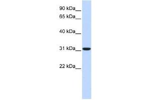 Carbonic Anhydrase VIII antibody used at 1 ug/ml to detect target protein. (CA8 抗体  (Middle Region))