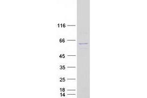 Validation with Western Blot