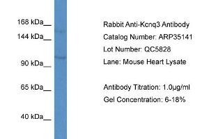 WB Suggested Anti-Kcnq3 Antibody   Titration: 1. (KCNQ3 抗体  (Middle Region))