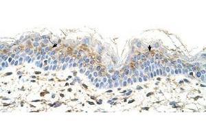Image no. 1 for anti-S100 Calcium Binding Protein A3 (S100A3) (N-Term) antibody (ABIN204985) (S100A3 抗体  (N-Term))